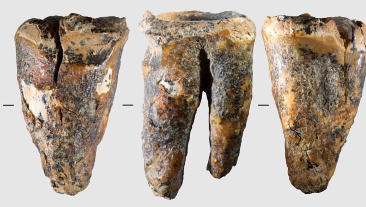 Neanderthals Performed the World’s Oldest Known Dental Treatment 59,000 Years Ago, Study Finds